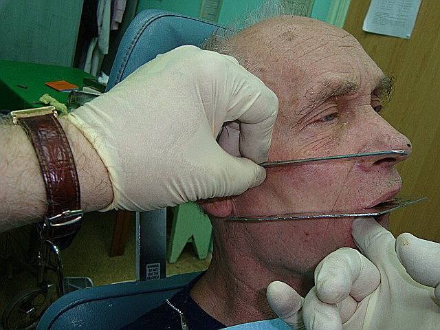 Манипуляции стоматолога