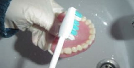 Как правильно чистить зубные протезы