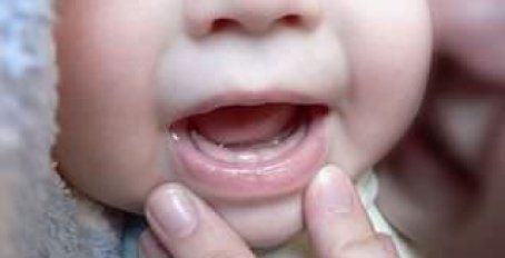 Как уменьшить боль при прорезывание зубов у детей