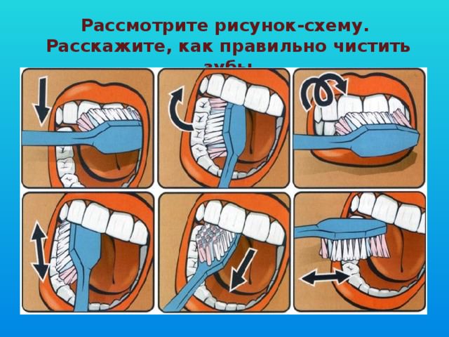 Как лечить чувствительность зубов в домашних условиях