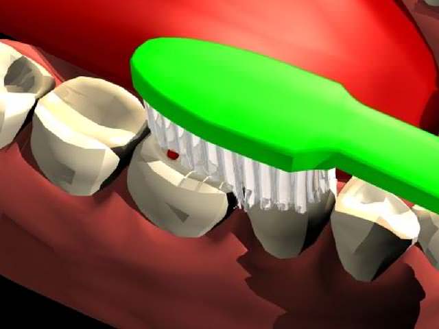 Чистка зубов