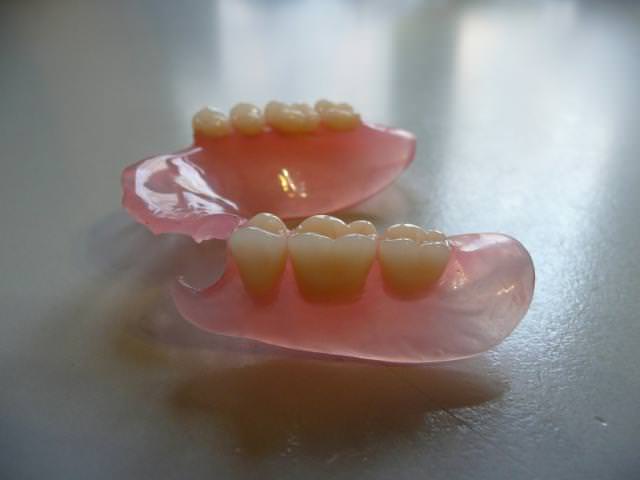 Зубной мост