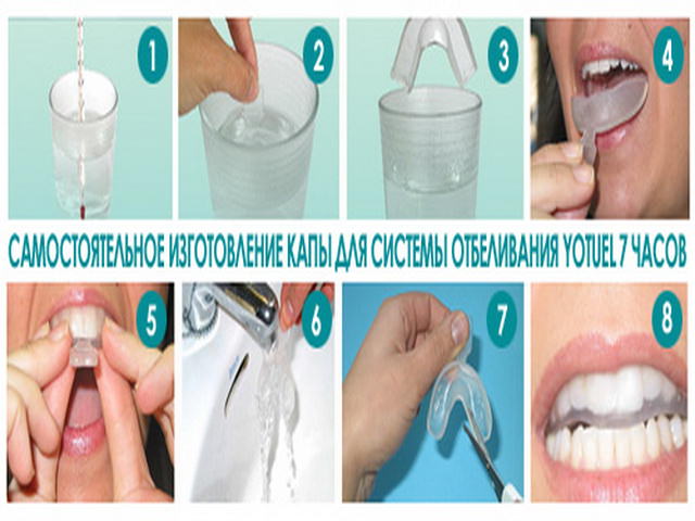 Капы для зубов для выравнивания фото до и после